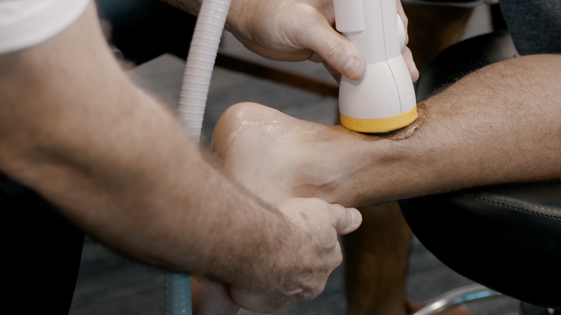 Softwave on achilles